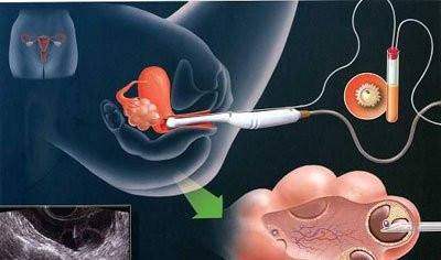 王建国